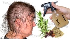 Rosemary For Hair Growth, Quick Hair Growth, Nyttige Tips, Hair Growth Spray