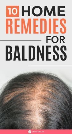 Hair Fall Remedy, Natural Hair Remedies, Natural Hair Growth Remedies, Hair Remedies For Growth, Home Remedies For Hair, Brittle Nails, Hair Control, Lost Hair