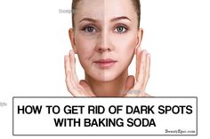 6 Ways to Use Baking Soda for Dark Spots | How Long it Take? Remove Hyperpigmentation, Brown Spots On Skin, Dark Spots On Face, Spot Remover, Brown Spots Removal, Brown Spots On Face, Dark Spots On Skin, Skin Care Wrinkles, Skin Spots