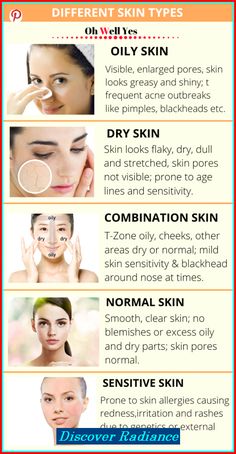 💞 Perfect Skin – The Comprehensive Solution for All Your Needs! skin care routine for oily skin, moisturizer skin care, wrinkle serum #hydration #skincareroutine #serum Haut Routine, Skin Facts, Skin Advice, Skin Care Routine Order, Dry Skin On Face, Types Of Skin, Skin Allergies, Body Scrubs, Dry Skin Care