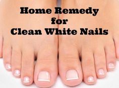 How To Make Your Nails White And Get Rid Of That Yellow Color Please Like Thanks :) Clean White Nails, Yellow Toe Nails, Baking Soda Scrub, Baking Soda Face, Toenail Fungus Remedies, Pedicure Colors, Pedicure At Home, Pedicure Designs