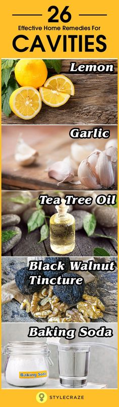 essential oils for dental care Home Remedies For Cavities, Remedies For Tooth Ache, Natural Headache Remedies, Back Pain Remedies, Tooth Pain, Holistic Remedies, Dental Problems, Natural Therapy