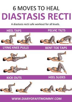 six moves to heal diastasis recti in 6 easy steps, including exercises