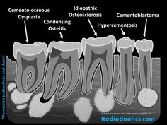 Dentist Career, Dental Hygienist School, Tooth Health, Soap Notes, Dental Images, Dental Posters, Kedokteran Gigi, Dental Hygiene School, Dentistry Student