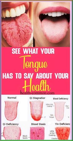 Nail Care and Tongue Health Tips Tongue Scraper, Health Signs, Nail Care Tips, Striped Nails, Nail Health, Black Spot, Health Problems, Natural Remedies