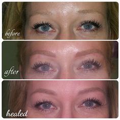 Korean Eyebrows Shaping, Blonde Microblading, Eyebrows Blonde, 3d Eyebrows, Color Eyebrows, Asian Eyebrows, Microbladed Brows, Celebrity Eyebrows, Eyebrow Before And After