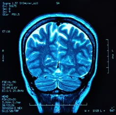 an image of the brain in blue