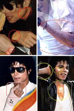 four different pictures of the same man with multiple circles around his neck and shoulder, including an image of michael jackson