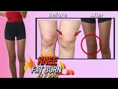 Knee Toning Exercises, Toned Knees Workout, Slimmer Knee Workout, Leg Burning Workout, Tone Knee Area, Workout For Knees, How To Slim Knees, How To Get Legs Like A Model, Fatty Knees Get Rid Of