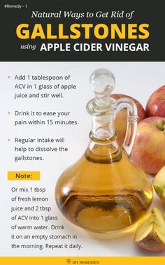 Gallstone Diet, Apple Cider Vinegar Remedies, Gallbladder Diet, Gall Bladder, Healing Remedies, Natural Healing Remedies, Diy Remedies