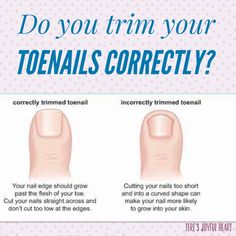 Different Pedicure Types, Toenail Care Tips, Shape Toenails, Glowup Advice, Nail Facts, Clean Toenails, Toenail Care, Nail Anatomy, Healthy Toenails