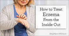 Do you suffer from eczema? The key to healing and reversing eczema permanently is to treat it from the inside out! Fungal Rash, The Body, New Jersey, Tampa, Inside Out, Healing, Diet, Key, Skin