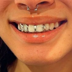 a close up of a person's smile with braces and piercings on their teeth