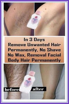 REMOVE UNWANTED HAIR PERMANENTLY - NO SHAVE NO WAX, REMOVAL FACIAL & BODY by Dusan Canevski | This newsletter was created with Smore, an online tool for creating beautiful newsletters for educators, businesses and more Upper Lip Hair Removal, Lip Hair Removal, Hair Remove