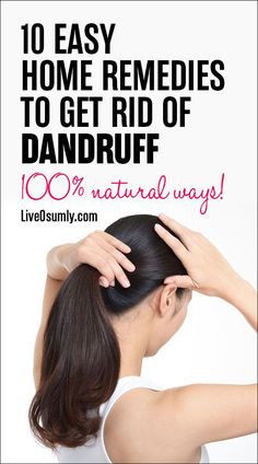 Have you been desperate to know how to get rid of dandruff for as long as you can remember? If yes, this article is for you. Learn the simple solutions to prevent dandruff in the comfort of your home easily and quickly. #Hair #HairCare Good Shampoo, Baking Soda For Dandruff, Baking Soda Health, Prevent Dandruff, Baking Soda Shampoo Recipe, Baking Soda For Hair, Shampoo For Gray Hair