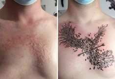 Times People Asked Tattoo Artists To Cover Up Their Scars And Birthmarks Birthmark Tattoo, Scar Cover Up, Mark Tattoo, Body Positivity Art, Scar Tattoo, Artist Tattoo, Inspiration Tattoo, Kawaii Tattoo, Style Tattoo