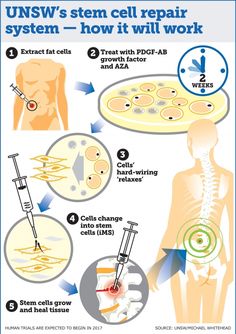 What Is Stem, Human Tissue, Cord Blood Banking, Stem Cell Research, Human Bones, Stem Cell Therapy, Animal Model, Cell Therapy, Regenerative Medicine