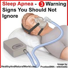 Sleep apnea is a potentially serious disorder which can lead to heart failure, stroke and metabolic disorders. Find here risk factors and how to know if you have sleep apnea. Home Remedies For Snoring, Asthma Inhaler, Snoring Remedies, How To Stop Snoring, Metabolic Disorders, Asthma Symptoms, Asthma Attacks, When You Sleep