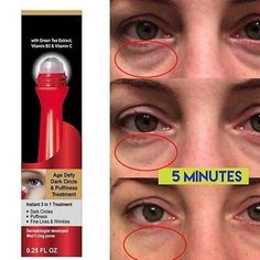 Wrinkle Remedies, Eye Puffiness, Eye Roller, Skin Nutrition, Under Eye Puffiness, Remove Dark Circles, Dark Circles Under Eyes, Dark Circle, Skin Secrets