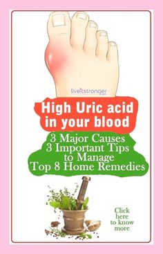 Lowering Your Uric Acid Level In Blood With 10 Effective Ways Natural Therapy, Foods To Avoid, Natural Medicine, Alternative Medicine