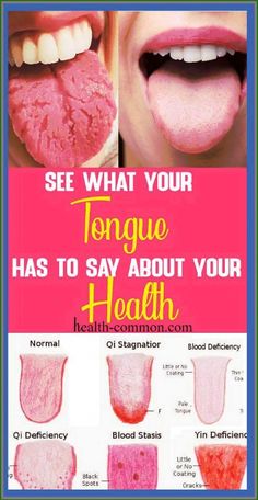 Nail Care and Tongue Health Tips A lot of nail care tips have been floating around recently. There has been a major focus on the nails and their health over the last few years. This is due to the fact... Tongue Scraper, Nail Care Tips, Striped Nails, Black Spot, Health Problems, Natural Remedies