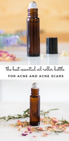 Essential Oil For Blackheads, Essential Oils For Back Acne, Acne Oil Blend, Essential Oils For Zits, Doterra Oils For Acne, Acne Essential Oil Recipe, Essential Oils For Pimples, Acne Roller Ball Essential Oil, Essential Oils For Acne Clear Skin