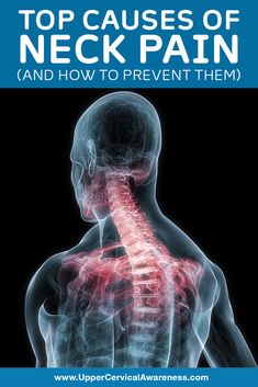 Neck Pain Remedies, Neck Hurts, Neck And Shoulder Muscles, Spine Pain, Lower Back Pain Exercises, Sciatic Nerve Pain