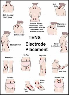 Tens Electrode Placement Tens Electrode Placement, K Tape, Back Pain Remedies, Ankle Pain