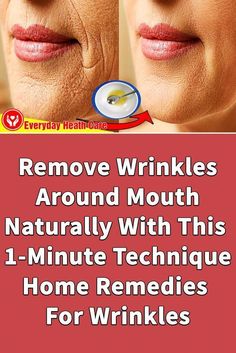 Within weeks I noticed tighter and hydrated skin, reduced wrinkles and age spots, as well as radiance and glow #skincare #darkspots #acne #removewrinkles #wrinkles #antiaging #facemask Mouth Exercises, Wrinkles Around Mouth, Skin Tightening Essential Oil, Wrinkles Remedies, Home Remedies For Wrinkles, Smokers Lines, Glow Skincare