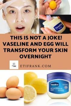 Vaseline Uses For Face, Face Wrinkles Remedies, Wrinkles Remedies Face, Natural Facial Mask, Vaseline Uses, Wrinkle Remedies, Skin Care Wrinkles, Beauty Tips For Glowing Skin