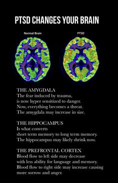 two mri images with the words psd changes your brain written below them in different languages