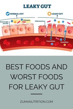 Best Foods and Worst Foods for Leaky Gut Tea For Leaky Gut, Foods To Avoid With Leaky Gut, Repair Leaky Gut, Leaky Gut Meal Plan Shopping Lists, Fixing Leaky Gut, Leaky Gut Symptoms Natural Remedies, How To Fix Leaky Gut, How To Heal Gut, Leaky Gut Diet Plan Food Lists