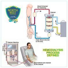 the diagram shows how an oxygen machine works and what it is doing to work with