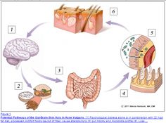 Use this comprehensive list of 14 SIBO symptoms to assess if you have intestinal bacterial overgrowth. In addition you will also learn what to do about it. Shampoo Diy, Wahls Protocol, Treat Acne Naturally, Gut Inflammation, Systemic Inflammation, Small Intestine Bacterial Overgrowth, Key To Losing Weight, Acne Vulgaris, Beach Walking