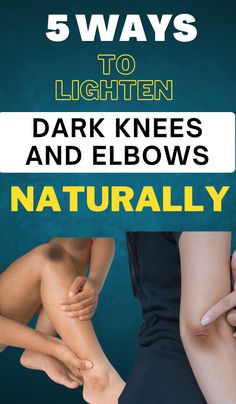 5 Ways To Lighten Dark Knees And Elbows Naturally Dark Knees And Elbows, Quotes About Self Care