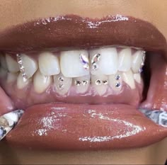 Grills Teeth, Tooth Gems