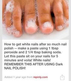 Stained Nails, Skin Care Routine For 20s, Catholic Education, Pinterest Nails, Age Gracefully, Pinterest Diy, Shellac Nails, Foot Care