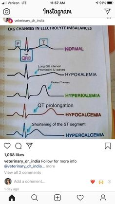 Heart Rythym Chart, Nursing School Studying Cheat Sheets, Nursing School Life, Nurse Skills, Medical Assistant Student, Nursing School Motivation, Medical School Life