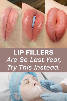 Bigger Lips Naturally, Diy Lip Plumper, Plump Lips Naturally, City Lips, Fuller Lips, Natural Face Skin Care, Healthy Lips, Lip Filler, Lip Fillers