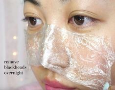 Here's a beauty hack on how to get rid of blackheads with vaseline overnight. All you need are Vaseline and plastic wrap. How To Remove Blackheads With Vaseline, Vaseline For Blackheads, Black Head Remover Diy, Diy Blackhead Remover, Get Rid Of Pores, Sebaceous Filaments, Vaseline Uses, Blackhead Extraction