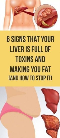 Our liver detoxifies our body by breaking down harmful substances, however, excess amounts of toxins build up when our body is unable to remove it through the natural process of sweating, bowel... | Healthy Liver, Liver Detox, The Liver, Liver Health, Stop It, Detox Smoothie, Oral Health, Health Remedies, Way Of Life Detox Smoothie, Stop It, Health Remedies, Health Problems, Healthy Tips