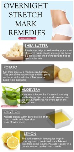 Acne Home Remedies, Remedies For Acne, Stretch Mark Remedies, Stretch Mark, Cystic Acne, Diy Skin, Skin Healing, Natural Home Remedies, Face Scrub