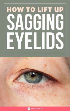 Saggy Eyes, Saggy Eyelids, Sagging Eyelids, Natural Skin Tightening, Droopy Eyelids, Eyelid Lift, Skin Care Wrinkles, Random Aesthetic, Beauty Remedies