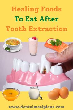 Eating After Tooth Extraction, Food After Tooth Extraction, Soft Foods To Eat, Foods High In Magnesium, Healthy Breakfast Diet, Soft Foods Diet, Dental Extraction, Low Fiber Diet, Foods With Iron