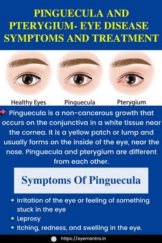 Pinguecula is a non-cancerous growth that occurs on the conjunctiva whereas Pterygium is the growth of the conjunctiva/mucous membrane. Mthfr C677t, Eye Diseases, Turmeric Vitamins, Disease Symptoms, Blemish Remover, Healthy Eyes, Functional Food, Eyes Problems, Nerve Pain