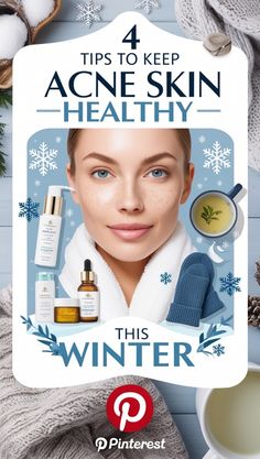 4 Tips to Keep Acne Skin Healthy This Winter Acne Skin, Acne Prone Skin, Healthy Skin, Acne