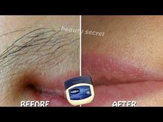 Get Rid Of Hair On Face, Uses For Vaseline Hacks, Vaseline Uses For Face Wrinkles, How To Get Rid Of Hair On Upper Lip, Natural Hair Remover For Face, Hair On Face Removal, How To Remove Hair On Face, Use Of Vaseline, Vaseline For Blackheads