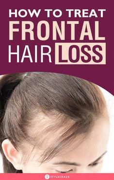 Frontal balding or receding hairline is the most common pattern of hair loss being observed in men above their 30’s. Frontal Hair, Herbs For Hair, Proper Diet, Healthy Hair Growth