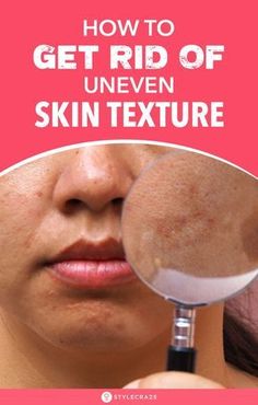 Textured Skin, Uneven Skin Texture