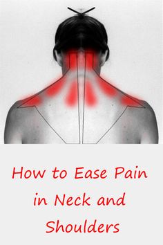 Head And Neck Stretches, Exercise Neck, Forward Head Posture Exercises, Sinus Congestion Relief, Cervical Pain, Neck And Shoulder Muscles, Neck Workout